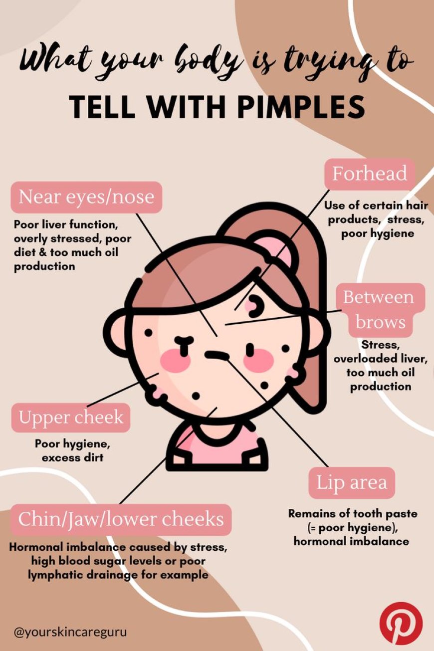 Bad Habits That cause Pimples