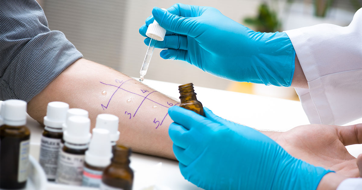 drug-penicillin-reaction-allergist