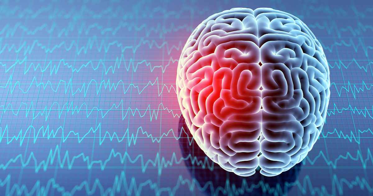 brain disease-diagnosis-als-mci-mild cognitive impairment-dementia
