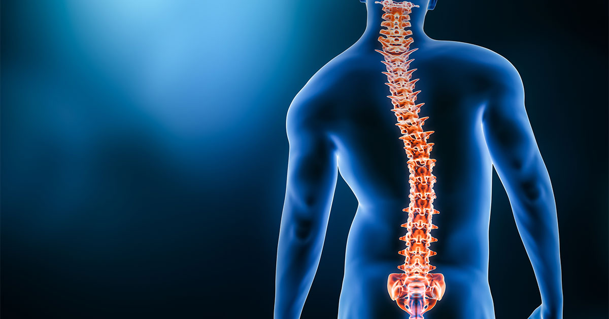scoliosis-spine health-quality of life-health problems-