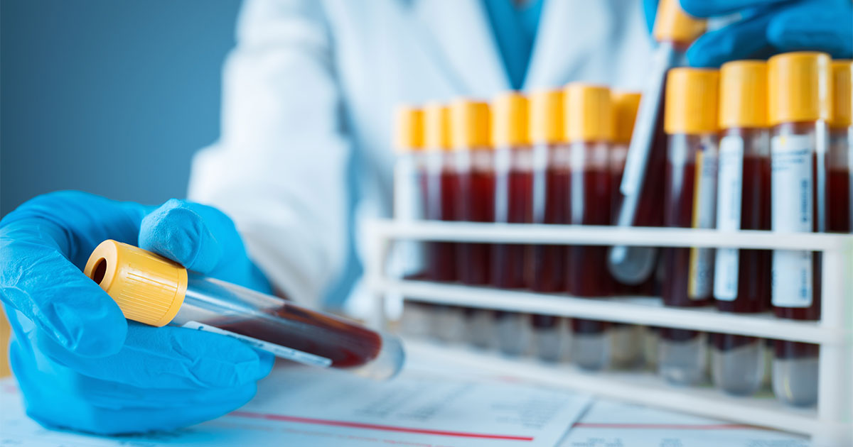 blood cancer-mpn-fibrosis-neurologist-mpn research