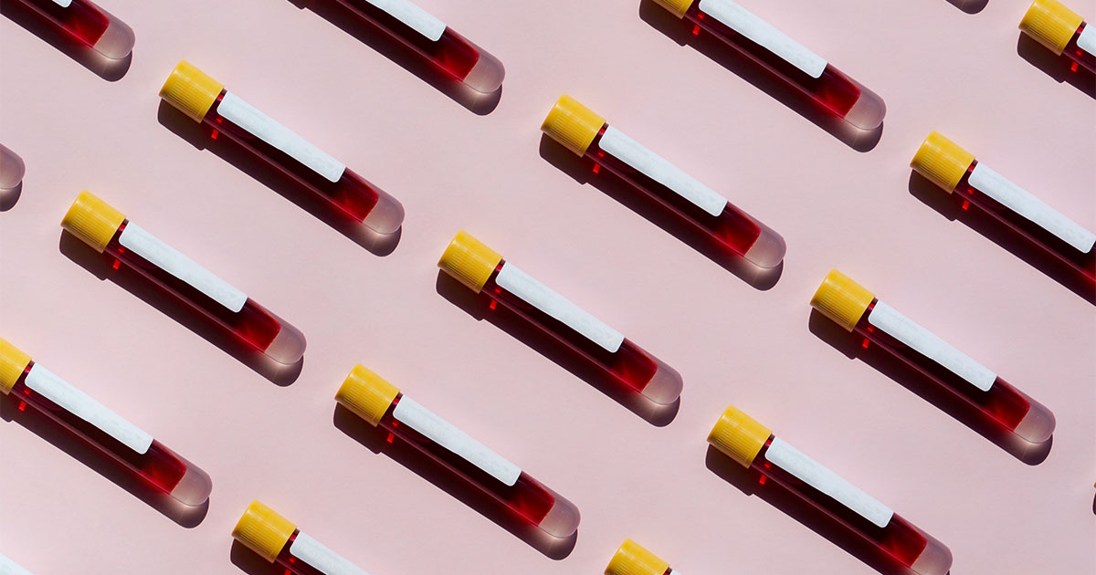 HIV myths-HIV-myths-epidemic