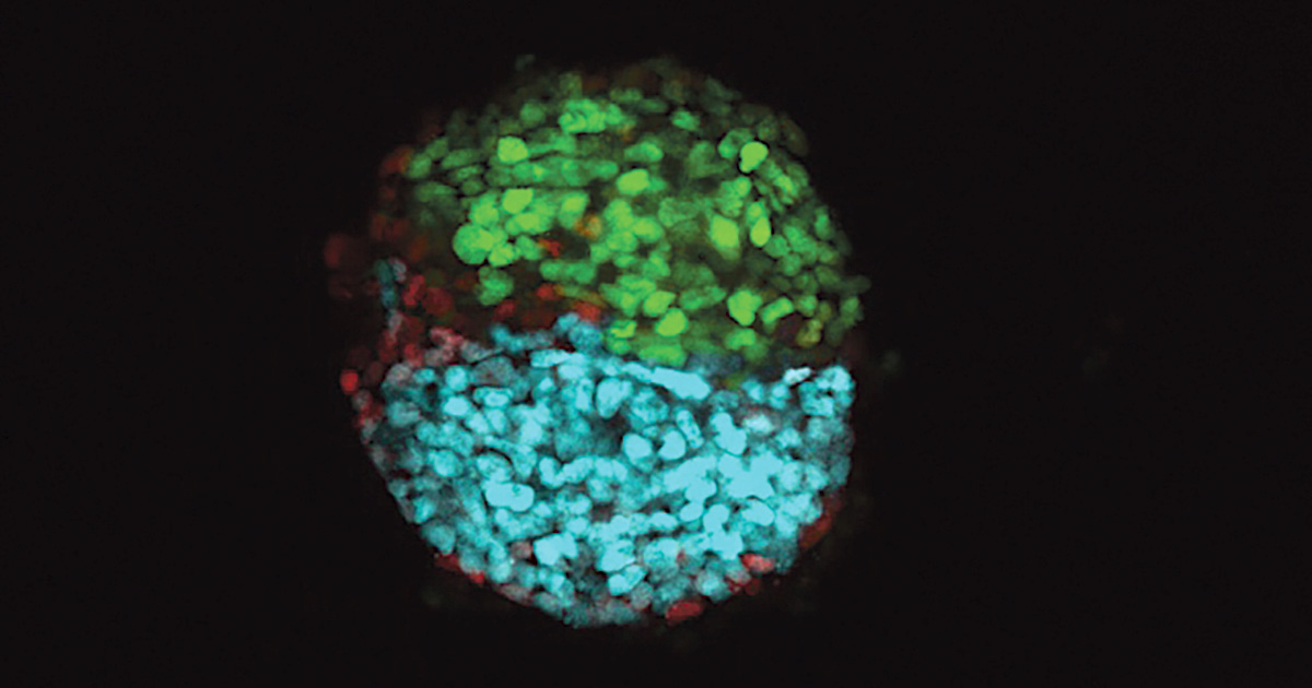 Stem cell