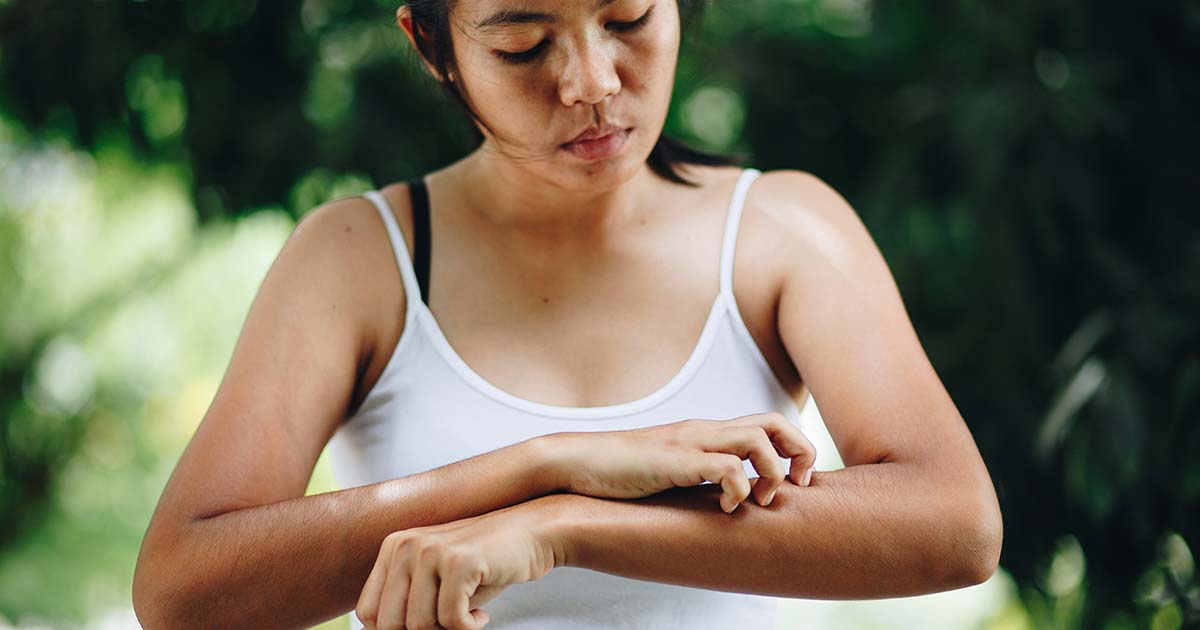 Woman with eczema scratching her arm