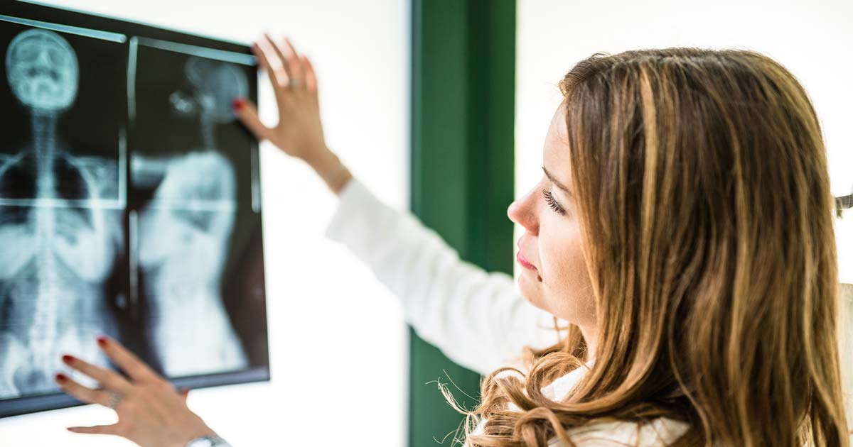Doctor examining an x-ray