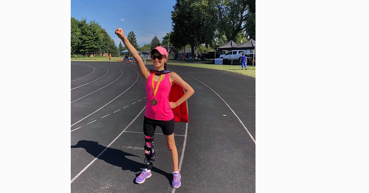 emma prosthetic leg childhood cancer