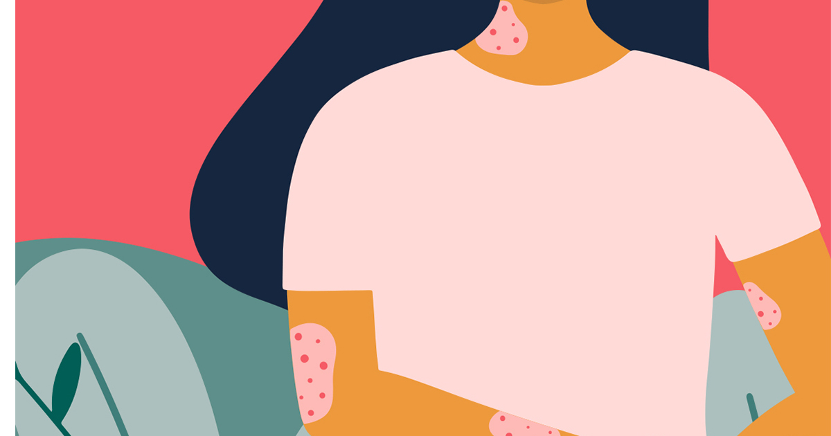psoriasis illustration day