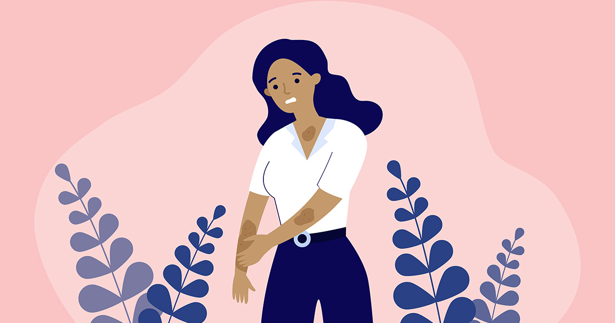 eczema cover photo