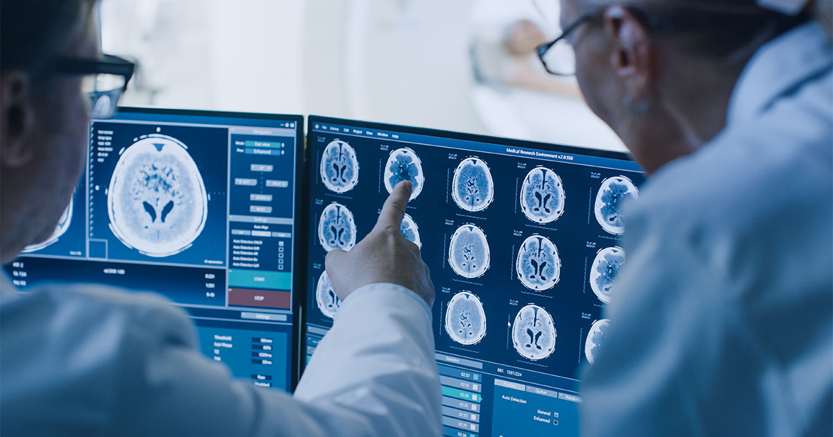 doctors examining brain scan