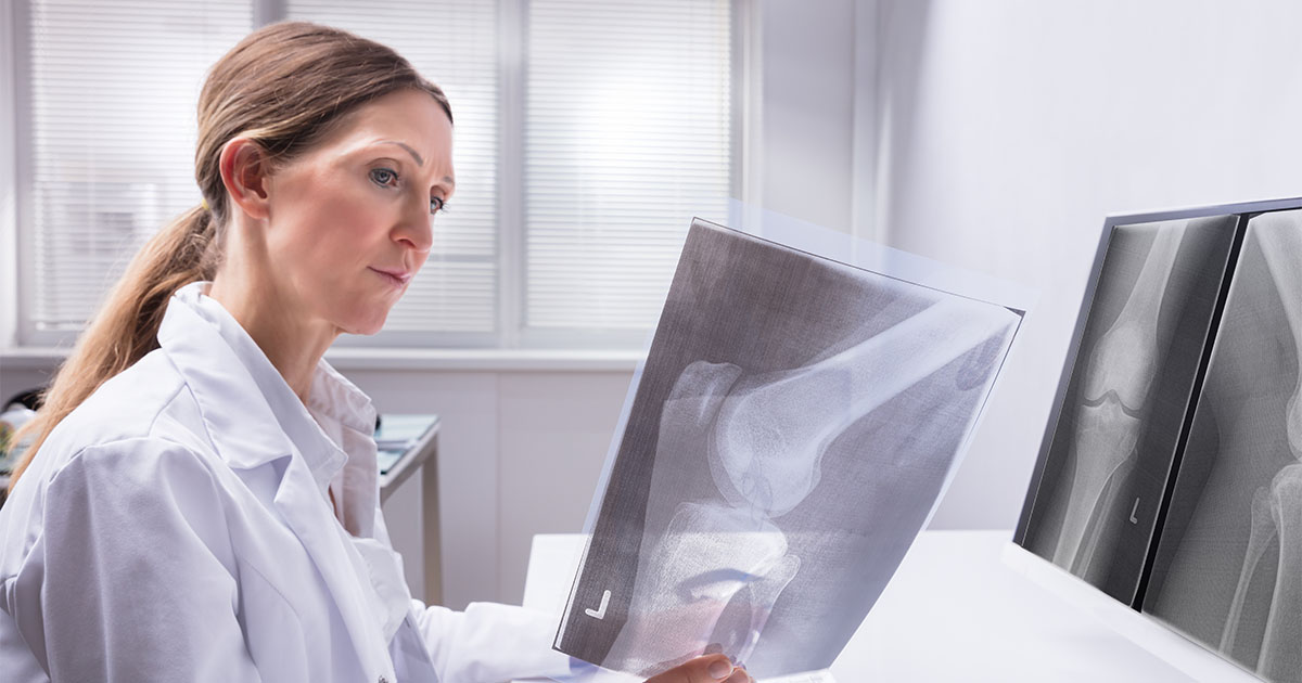 doctor examining xray