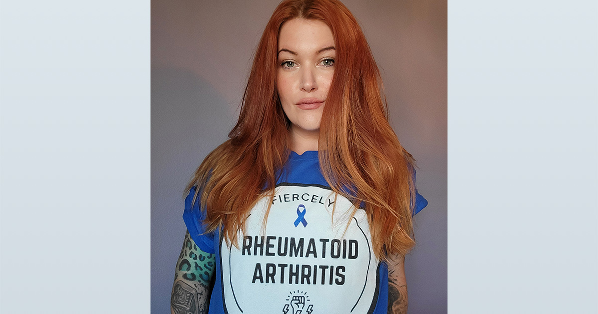 chronic eileen arthritis rheumatoid