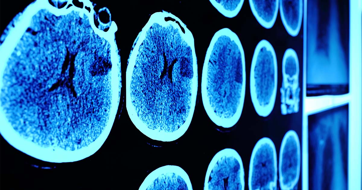 close up of neurology