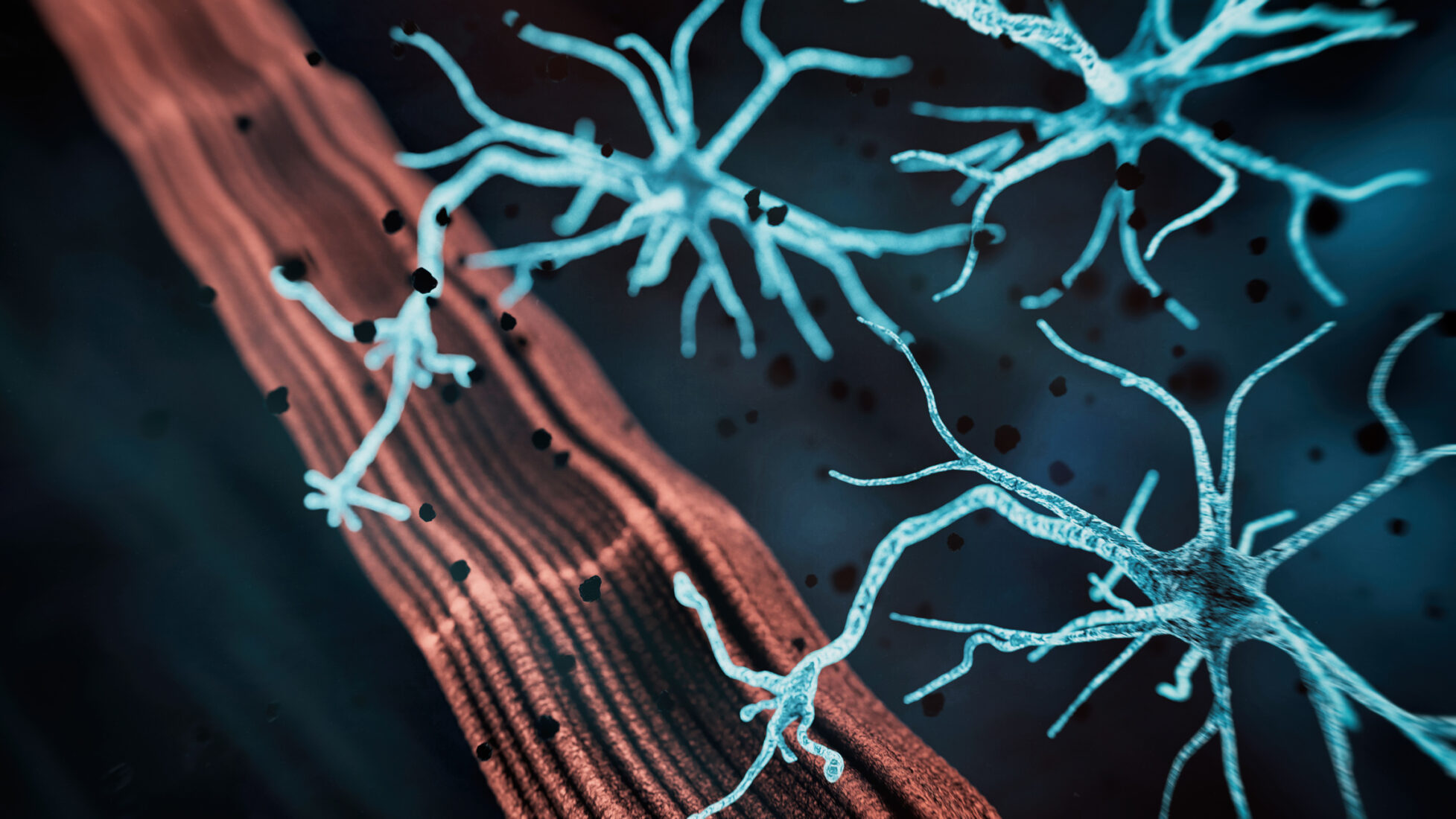 Improving Access to Innovative Care for Canadians Living with Autoimmune Neuromuscular Conditions