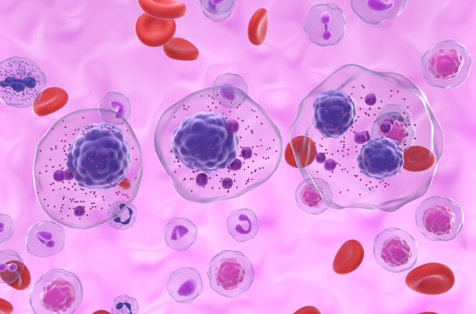 Beyond Survival: Rethinking Care for a New Era of Multiple Myeloma 