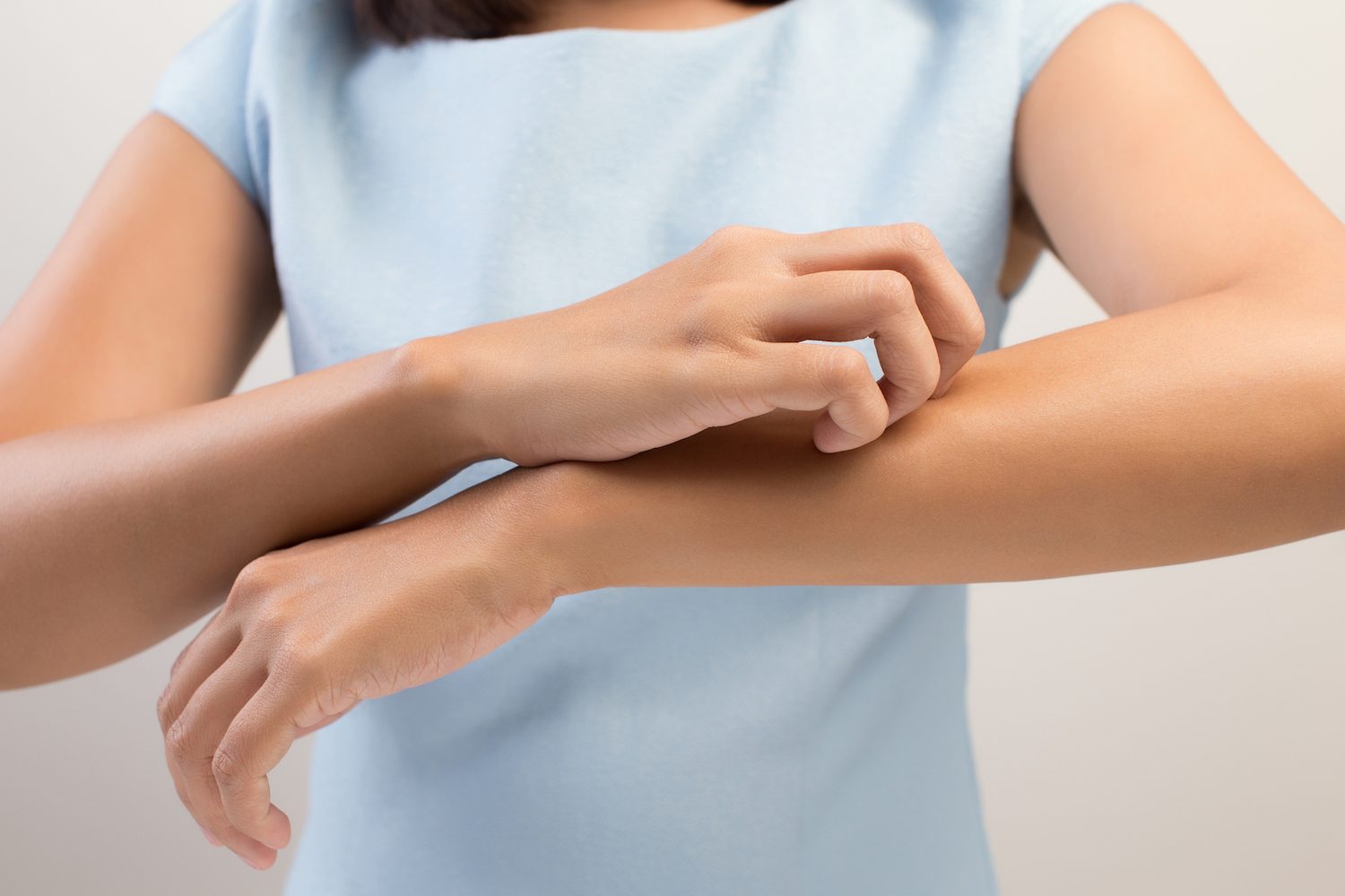 Girl,Scratch,The,Itch,With,Hand,,Arm,,Itching,,Concept,With
