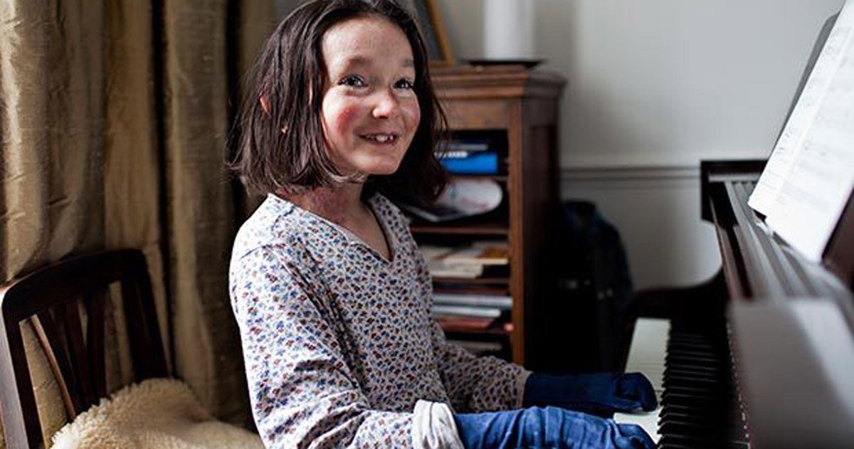 rare diseases sohana
