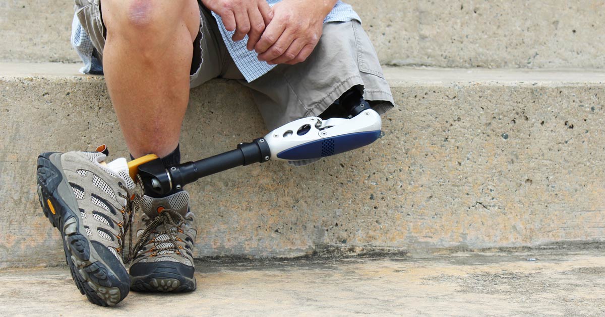 amputee ampuytated leg foot diabetes diabetic