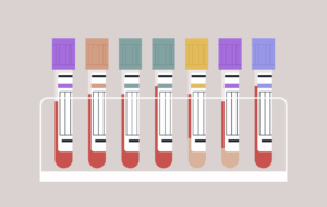 Vibrant blood test tubes are arranged neatly in a sleek holder, showcasing their unique colors and caps, symbolizing the critical role of laboratory testing in health assessments and diagnostics