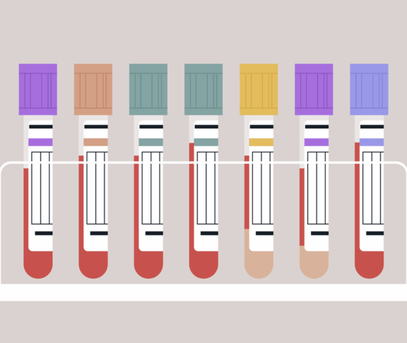 Vibrant blood test tubes are arranged neatly in a sleek holder, showcasing their unique colors and caps, symbolizing the critical role of laboratory testing in health assessments and diagnostics