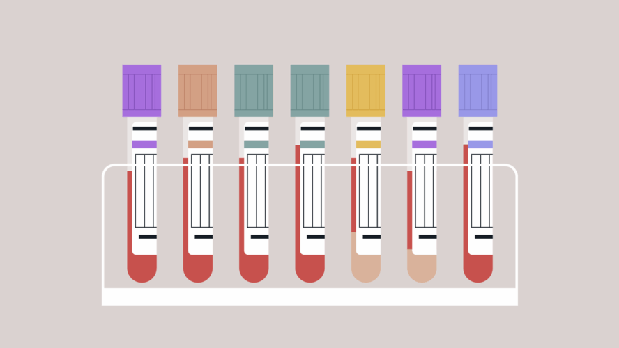 Vibrant blood test tubes are arranged neatly in a sleek holder, showcasing their unique colors and caps, symbolizing the critical role of laboratory testing in health assessments and diagnostics