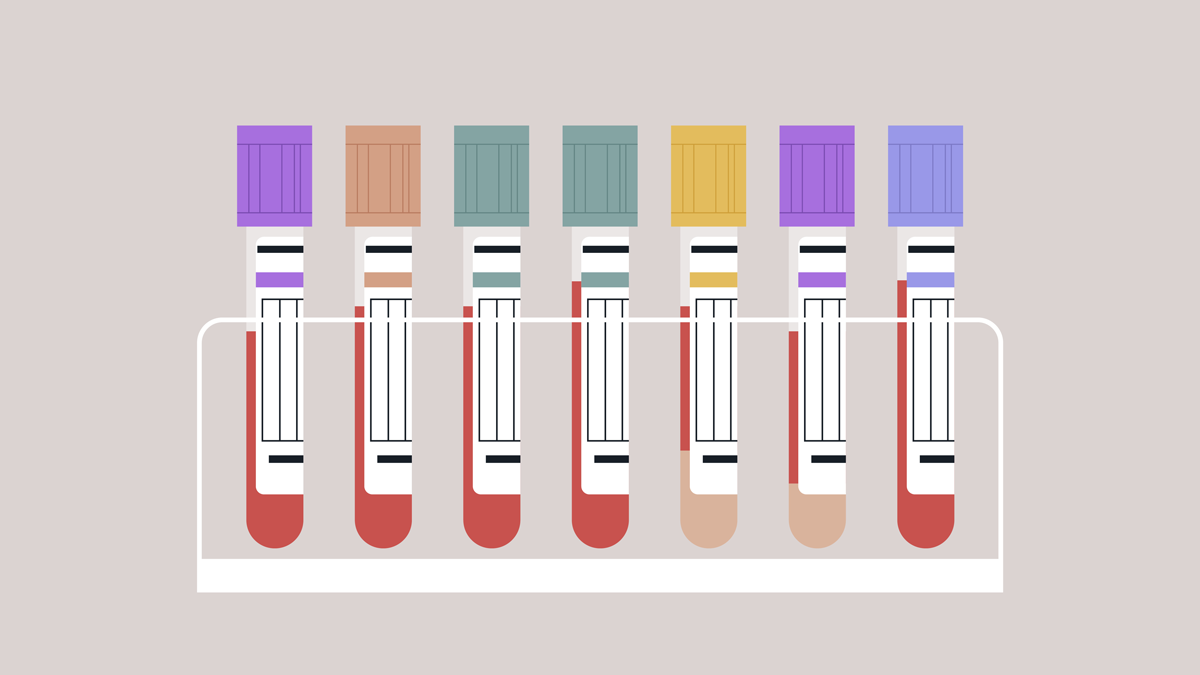 Vibrant blood test tubes are arranged neatly in a sleek holder, showcasing their unique colors and caps, symbolizing the critical role of laboratory testing in health assessments and diagnostics