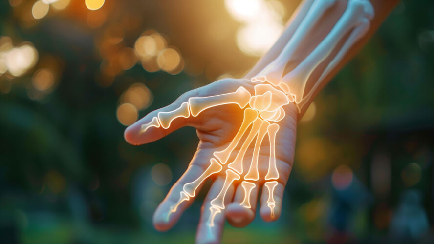 Phantom limb pain, hand with skeleton on it, physical injury joint body part healthy lifestyle ligament