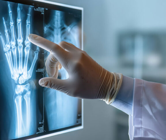realistic close-up of doctor analyzing x-ray in hospital, modern clinical environment, white coat and gloves