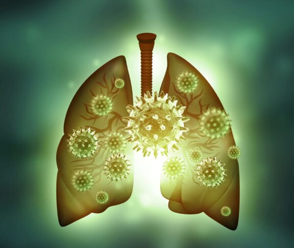 Human lungs virus infection