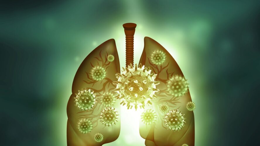 Human lungs virus infection