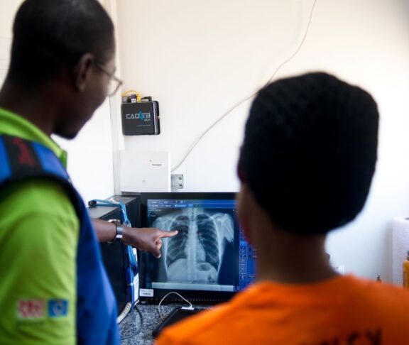 Healthcare professionals in Zambia reviewing chest x-rays during community screening project