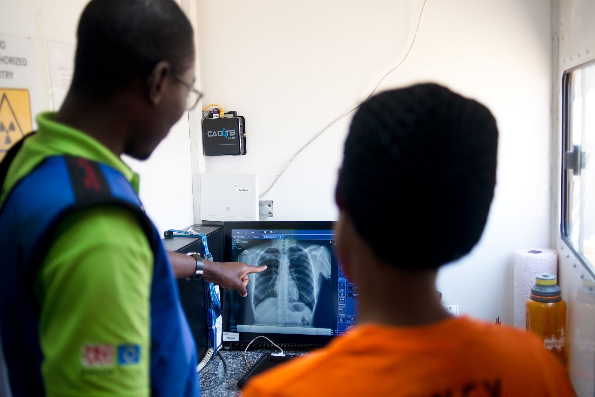 Healthcare professionals in Zambia reviewing chest x-rays during community screening project