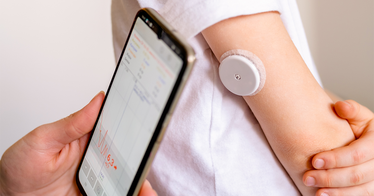 system of continuous monitoring of glucose on child's arm