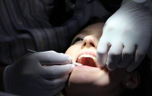 kvinde bliver tilset i munden af læge. Diabetikere må slås med tør mund og huller