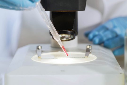 Biochemist preparing slide with blood sample, examines it under microscope
