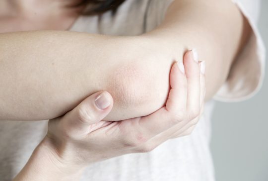 Winterizing dry itchy skin on the elbow area
