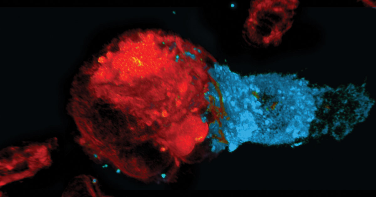 celler cancer