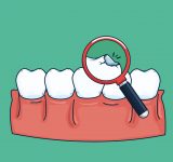 suun-hyvinvointi-keholle-keho-suu-yhteys