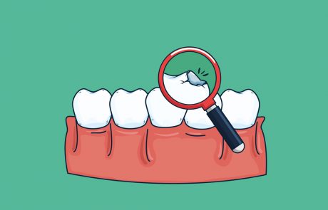 suun-hyvinvointi-keholle-keho-suu-yhteys