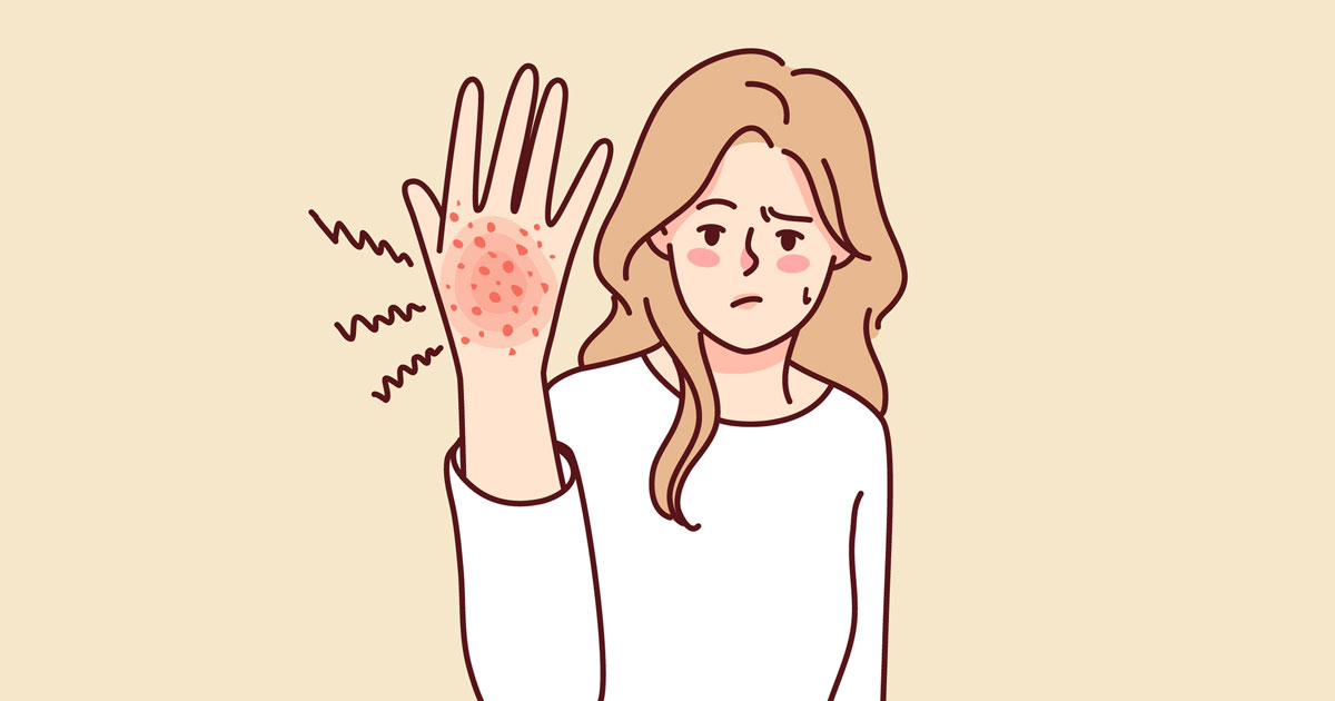 Unhappy woman suffer from rash on hand