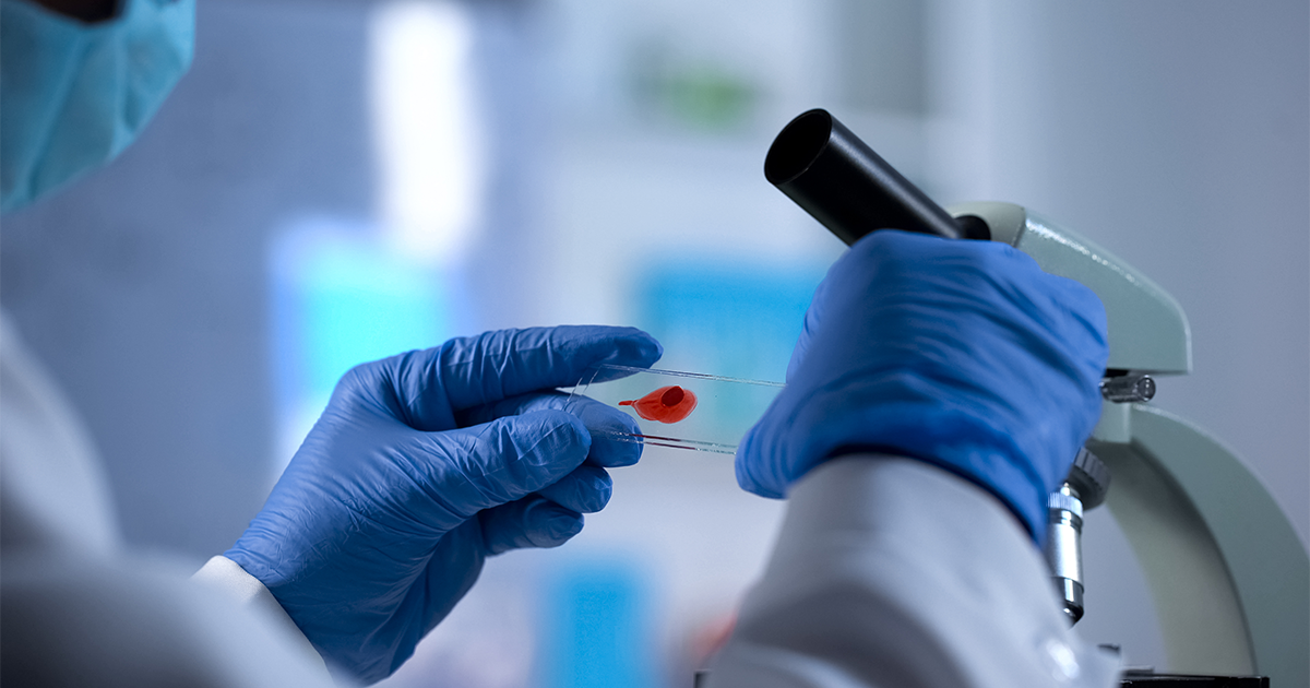 AIDS checkup