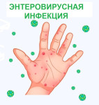 Профилактика энтеровирусной инфекции 