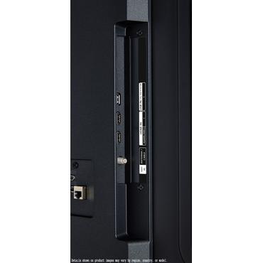 LG UHD AI 75" 4K LED TV 75UA7500 (2025)