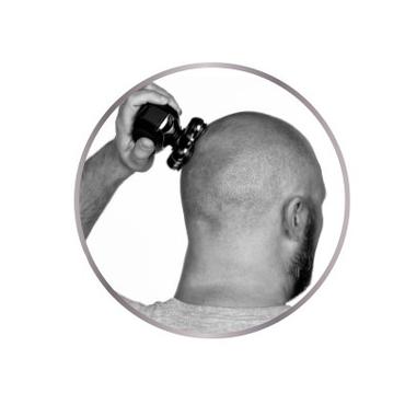 Remington RX5 Ultimate Series XR1500 - rakapparat f&ouml;r huvud