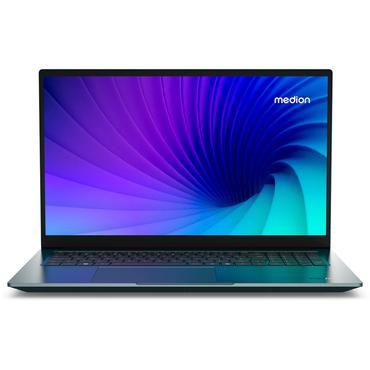 MEDION Bärbar - 155H - 16 GB - 1 GB - 17.3" - 1920 x 1080 pixlar - Windows 11 Home
