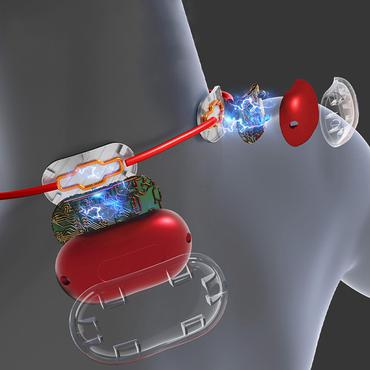 Media Tech Massageapparat