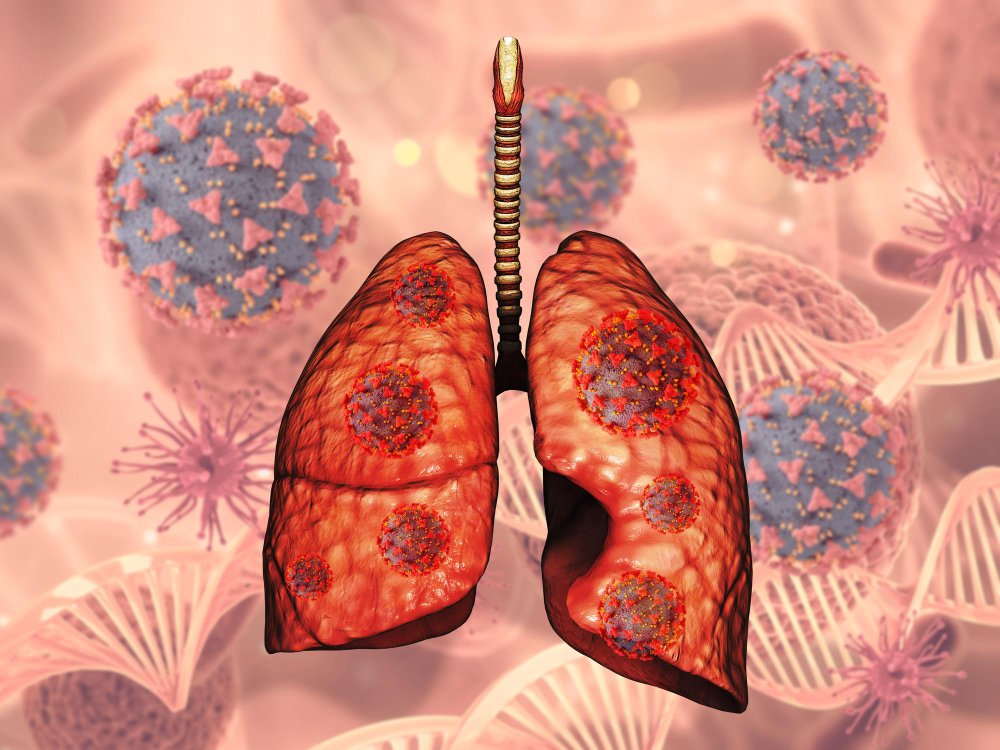 Artificial Intelligence-Driven Diagnosis of Lung Cancer with  Enhanced Efficiency