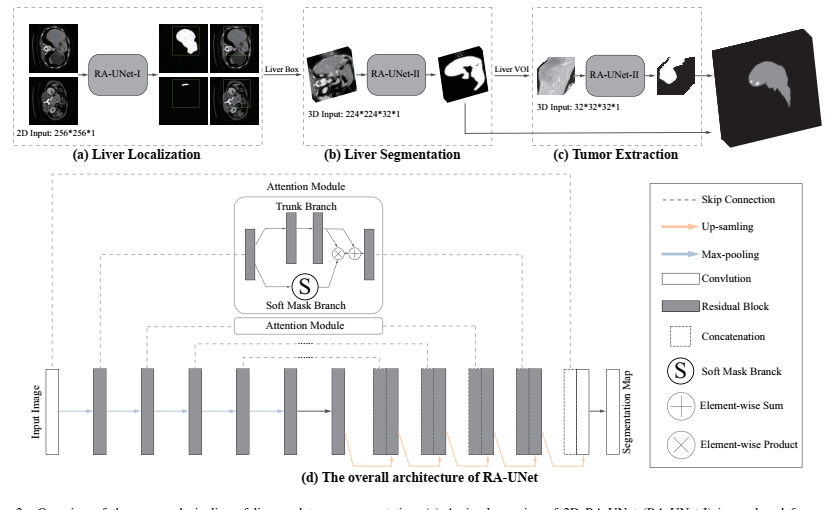 CT Liver Tumor Segmentation using a Hybrid Deep Convolutional Neural Network RA-UNet