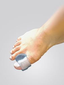 Toes-category