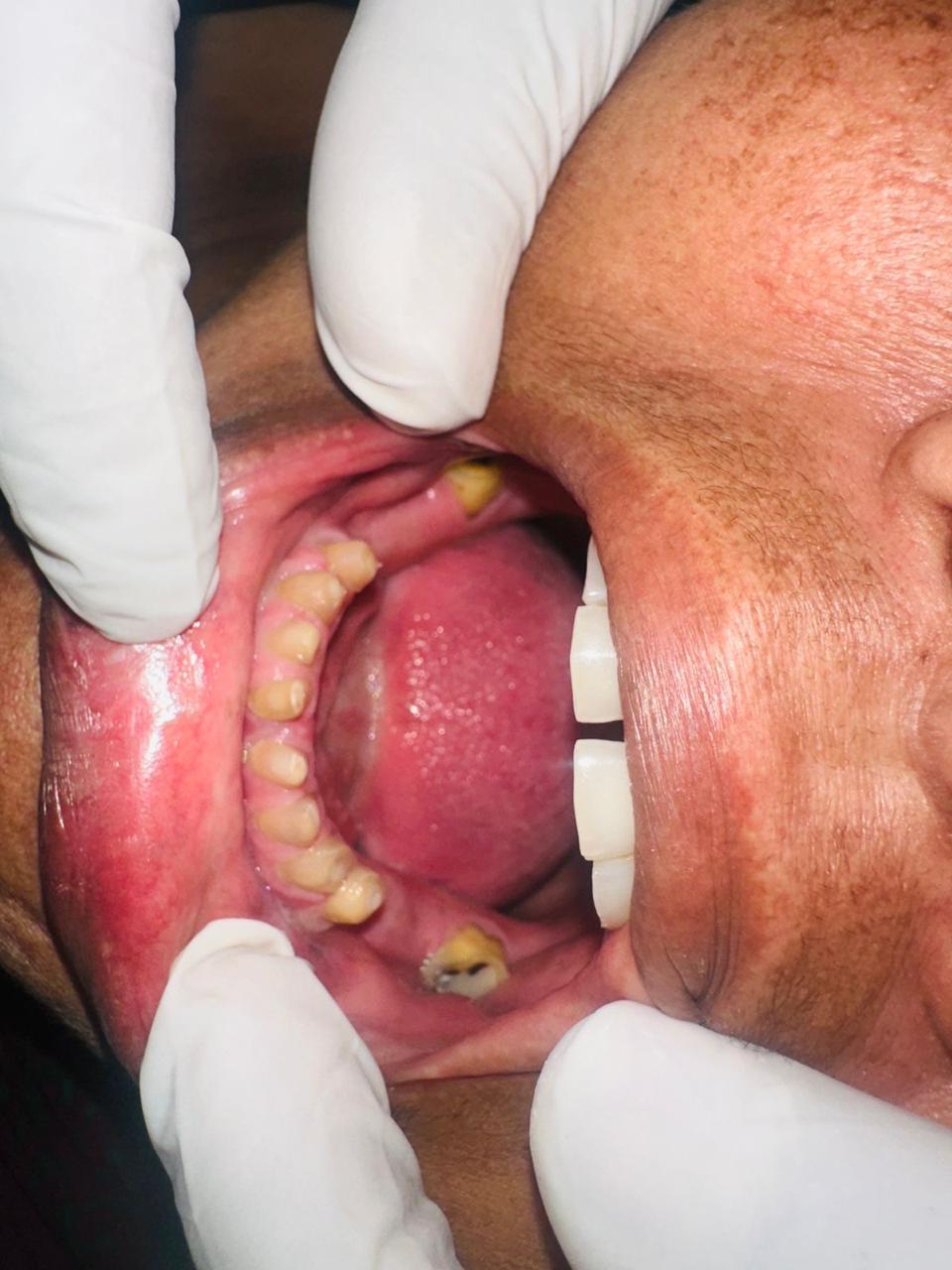 Before treatment